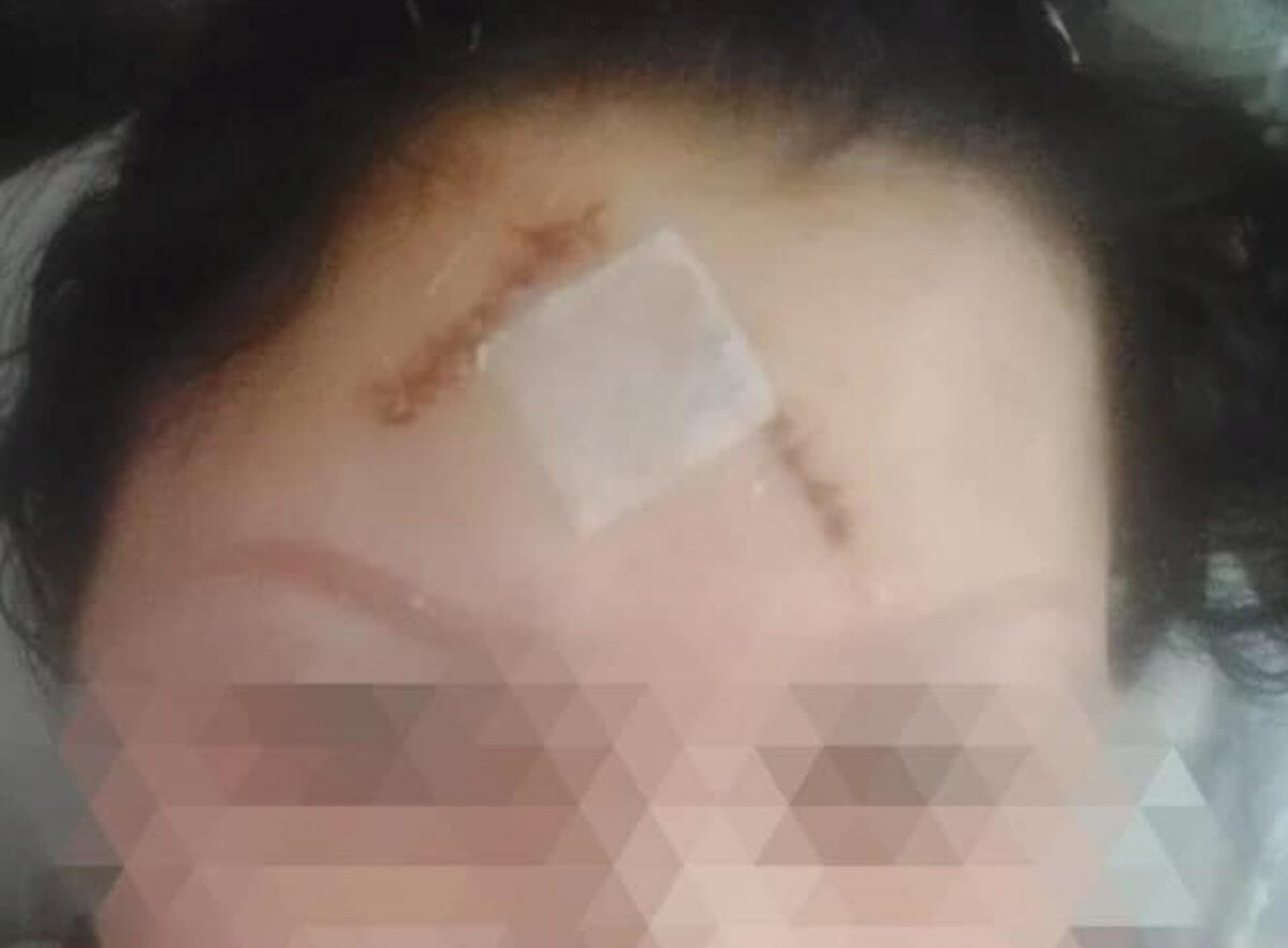 "Наложили 15 швов": сожитель нанес раны женщине и ее сыну в Талгаре