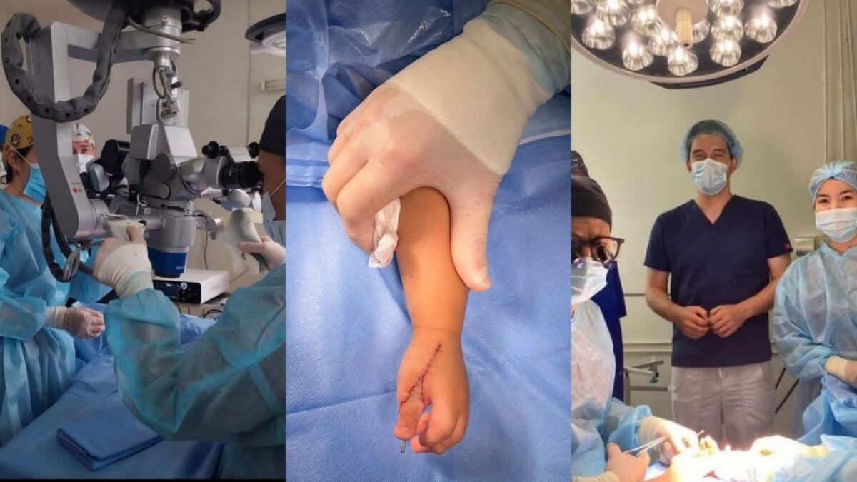 Палец с ноги на руку: в Алматы провели 6 сложнейших операций детям местные врачи и и микрохирург с мировым именем