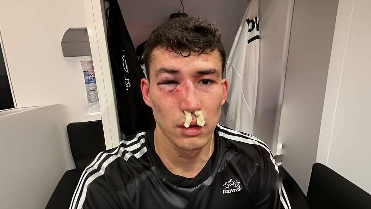 Бактиер Зайнутдинов после полученной травмы во время матча госпитализирован в Турции