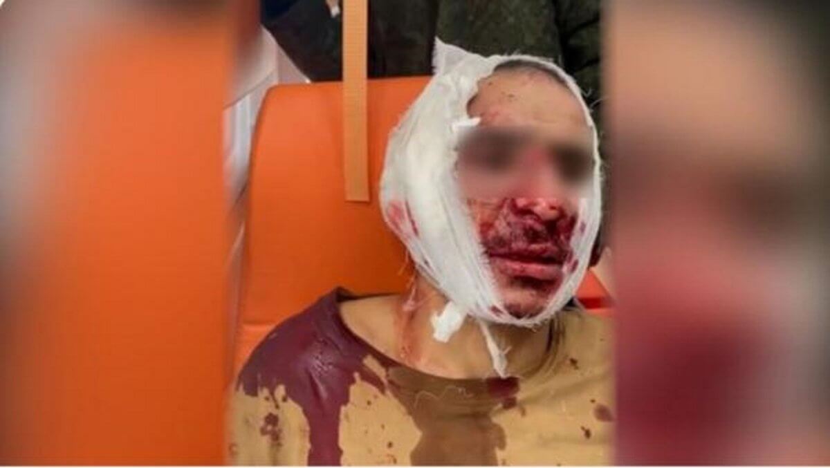 "Отрезали ухо". В сети появилось видео задержания еще одного подозреваемого в теракте в Москве