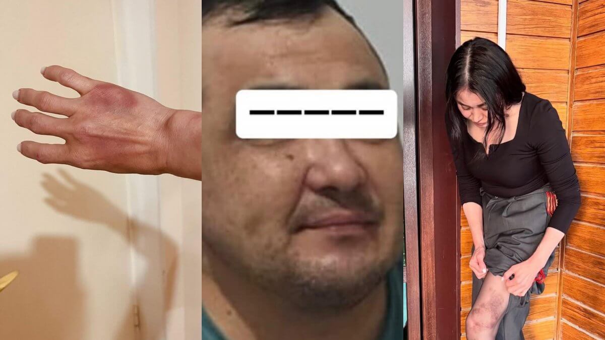 «Избивал, душил, угрожал сбросить с 17-го этажа»: в Актау женщина обвинила бывшего мужа в жестоком насилии