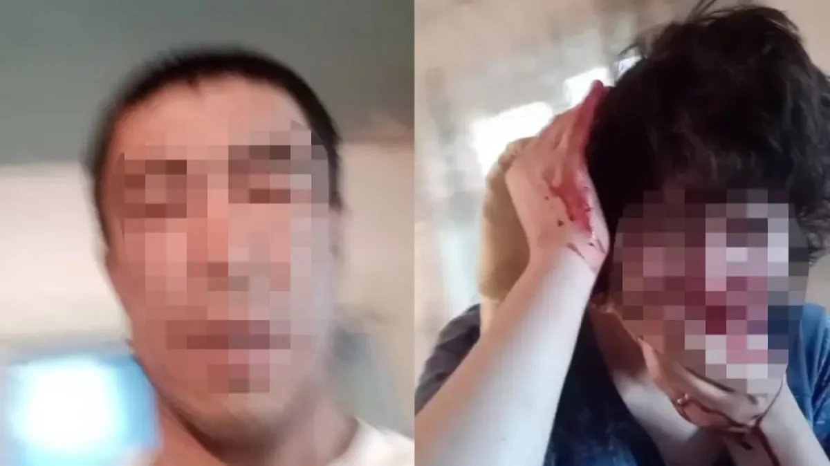 В Алматинской области мужчина избил жену: у пострадавшей сломан нос и поврежден слух