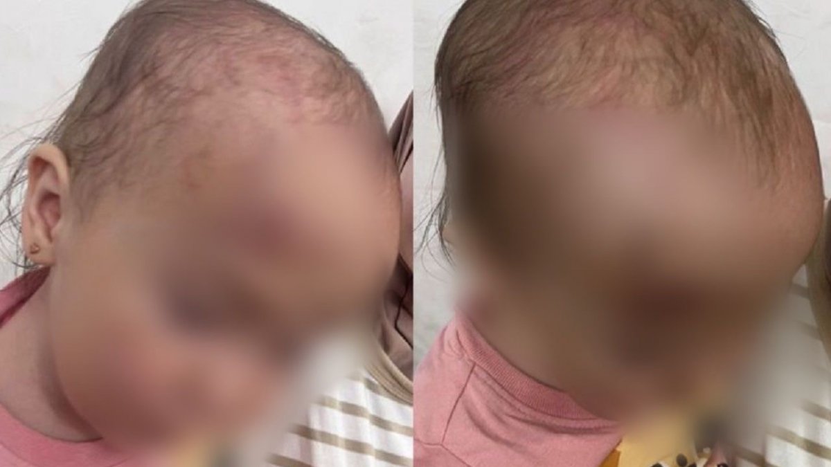 «Тихий час без присмотра»: в детсаду Актау малышка пострадала от жестокости сверстников