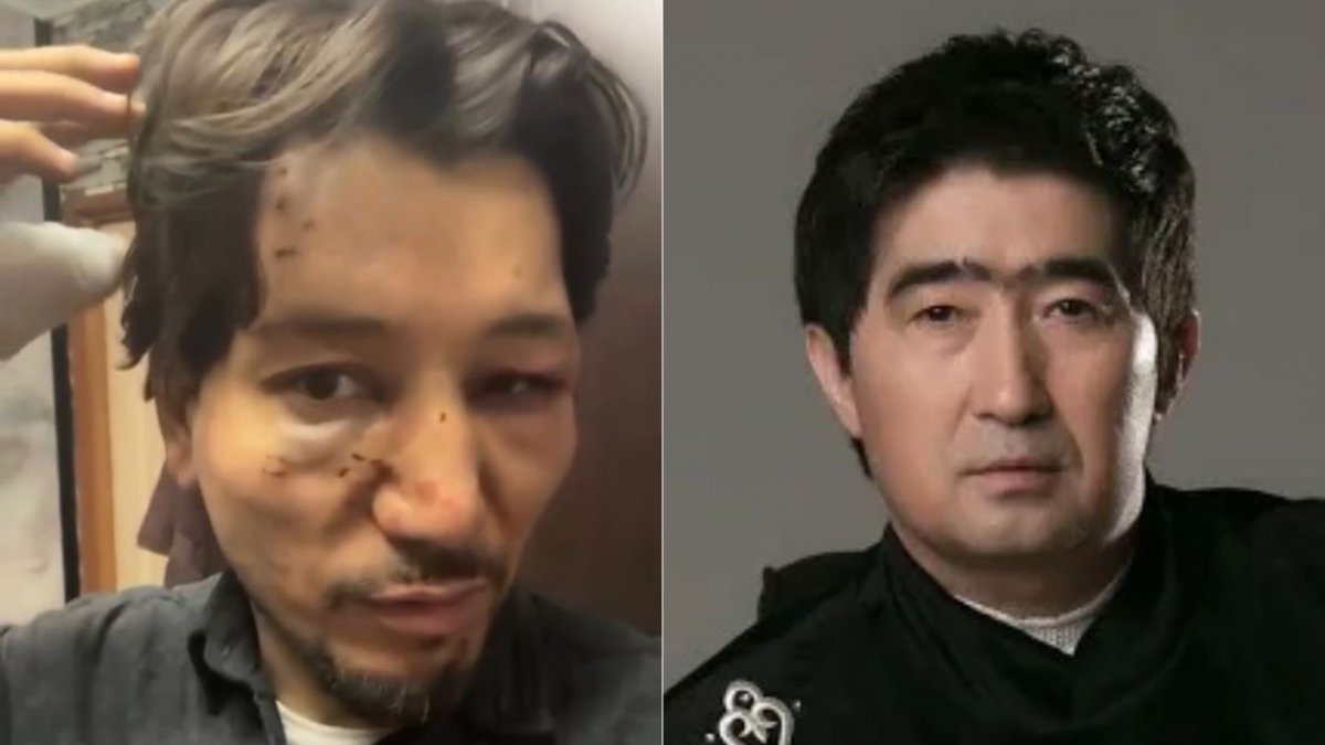 Новый участник группы  «Нур-Мукасан» обвинил Мукасана Шахзадаева в избиении