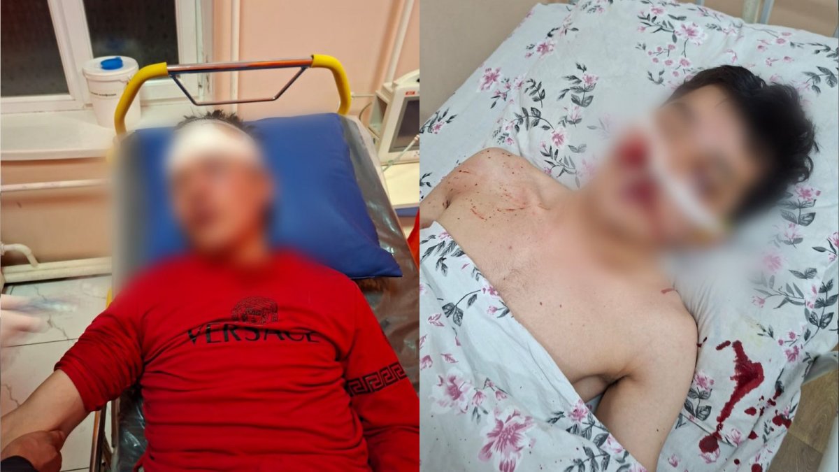 «Били ногами по голове до судорог»: родные избитого в Туркестанской области парня требуют наказать толпу нападавших