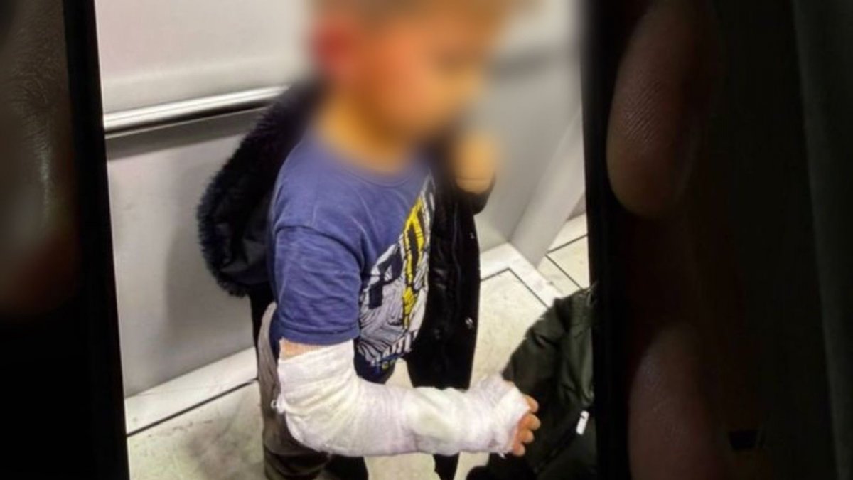 Трое  детей среди пострадавших: облздрав сообщил о состоянии после пожара в «Балапарк» в Семее