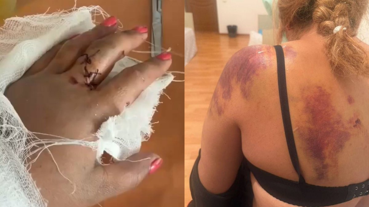 Женщину жестоко избили лопатой на глазах у детей в области Жетысу