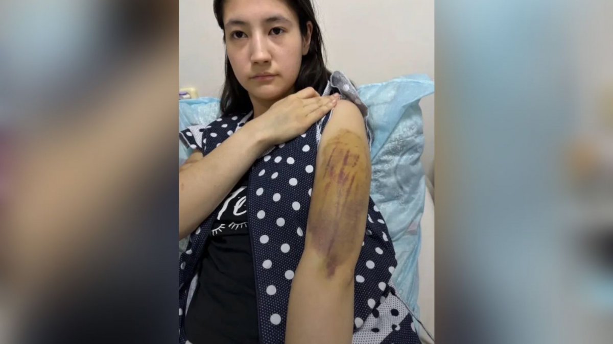 В Караганде муж-тиран довел 18-летнюю девушку до удаления селезенки и отобрал ребенка