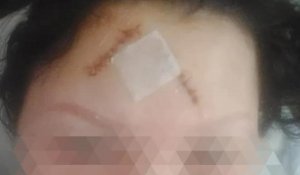 "Наложили 15 швов": сожитель нанес раны женщине и ее сыну в Талгаре
