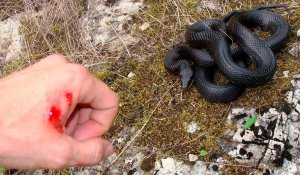 Депутата Мажилиса во время отпуска укусила змея