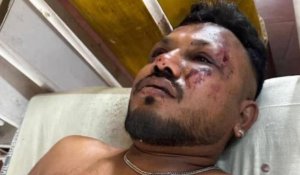 «Очнулся среди тел»: в авиакатастрофе Air India выжил только один пассажир