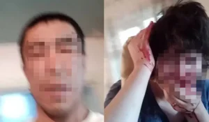В Алматинской области мужчина избил жену: у пострадавшей сломан нос и поврежден слух