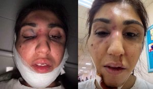 После трех недель молчания: полиция Алматы возбудила дело по факту избиения женщины бывшим мужем