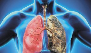 «Это не рак»: пользователь сети рассказала, как казахстанские врачи ошиблись в диагнозе