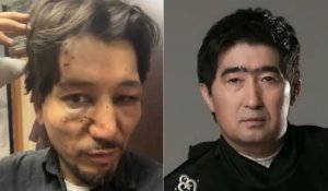 Новый участник группы  «Нур-Мукасан» обвинил Мукасана Шахзадаева в избиении