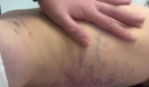 «Отец жестоко избил 3-летнюю дочь»: стало известно о состоянии ребенка