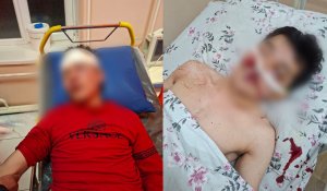 «Били ногами по голове до судорог»: родные избитого в Туркестанской области парня требуют наказать толпу нападавших