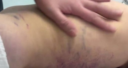 «Отец жестоко избил 3-летнюю дочь»: стало известно о состоянии ребенка