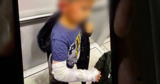 Трое  детей среди пострадавших: облздрав сообщил о состоянии после пожара в «Балапарк» в Семее